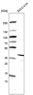 Western blot analysis in human cell line SCLC-21H.