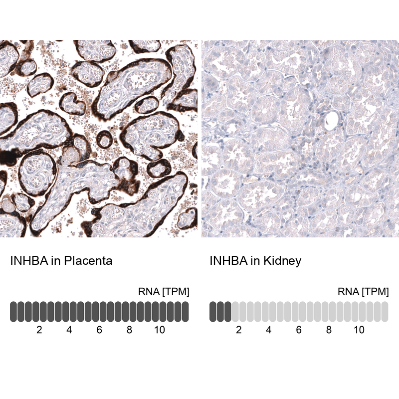 Anti-INHBA Antibody
