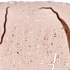 Immunohistochemical staining of rat cerebral cortex shows moderate cytoplasmic positivity in a subset of neurons in the upper layers.