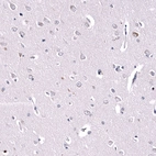 Immunohistochemical staining of human cerebral cortex shows weak to moderate cytoplasmic positivity in a subset of neurons.