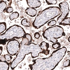Immunohistochemical staining of human placenta shows strong cytoplasmic positivity in trophoblastic cells.