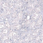 Immunohistochemical staining of human kidney shows no positivity in cells in tubules as expected.