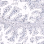Immunohistochemical staining of human prostate shows no positivity in glandular cells as expected.