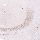 Immunohistochemical staining of mouse brain shows moderate positivity in neuronal processes in the CA3 area of the hippocampus.
