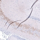 Immunohistochemical staining of rat brain shows moderate positivity in neuronal processes in the CA3 area of the hippocampus.