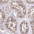 Immunohistochemical staining of human testis shows moderate to strong membranous positivity in cells in seminiferous ducts.