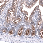 Immunohistochemical staining of human duodenum shows moderate to strong membranous positivity in glandular cells.