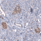 Immunohistochemical staining of human pancreas shows moderate membranous positivity in the islets of Langerhans.