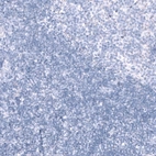 Immunohistochemical staining of human tonsil shows no positivity in non-germinal center cells as expected.
