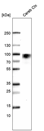 Western blot analysis in human cerebral cortex tissue.