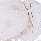 Immunohistochemical staining of rat brain shows weak to moderate positivity in neuronal processes in the CA3 area of the hippocampus.
