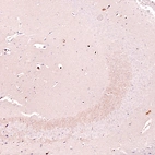 Immunohistochemical staining of mouse brain shows weak to moderate positivity in neuronal processes in the CA3 area of the hippocampus.
