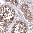 Immunohistochemical staining of human testis shows strong membranous positivity in cells in seminiferous ducts.