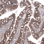 Immunohistochemical staining of human duodenum shows strong membranous positivity in glandular cells.
