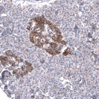 Immunohistochemical staining of human pancreas shows moderate membranous positivity in the islets of Langerhans.