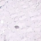 Immunohistochemical staining of human skeletal muscle shows no positivity in myocytes as expected.