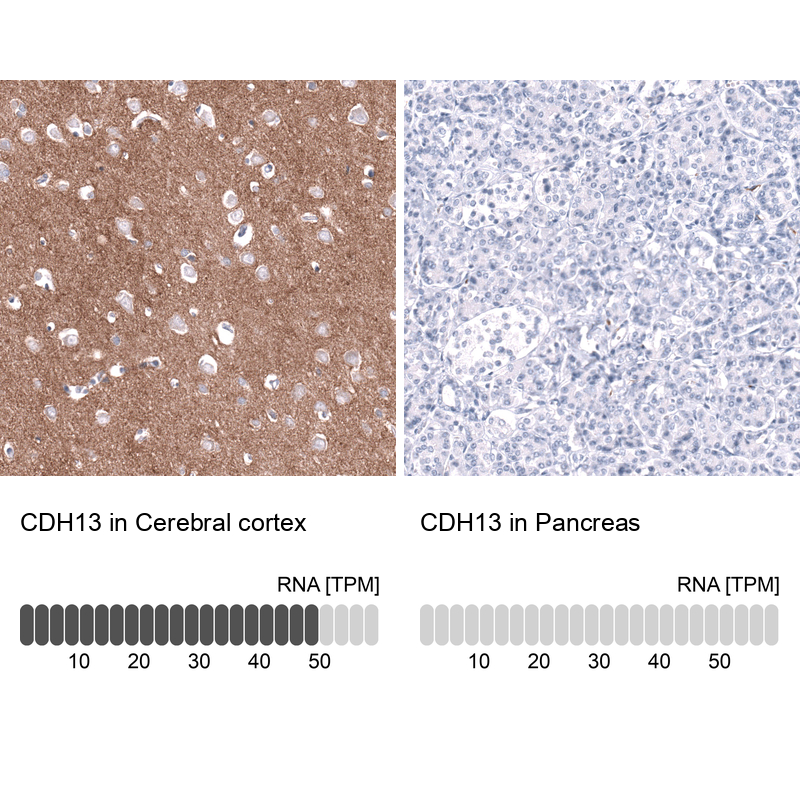 Anti-CDH13 Antibody