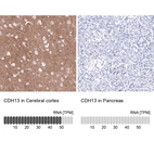 Anti-CDH13 Antibody