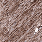 Immunohistochemical staining of human heart muscle shows strong membranous positivity in cardiomyocytes.
