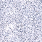 Immunohistochemical staining of human pancreas shows no positivity in exocrine glandular cells as expected.