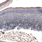 Immunohistochemical staining of mouse embryo, E14 shows moderate to strong nuclear positivity in neuronal cells in the developing cortex.