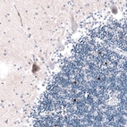 Immunohistochemical staining of human cerebellum shows strong nuclear positivity in a subset of neurons in the granular layer.