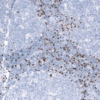 Immunohistochemical staining of human tonsil shows strong nuclear positivity in non-germinal center cells.