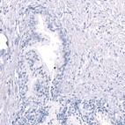 Immunohistochemical staining of human prostate shows no positivity in glandular cells as expected.