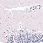 Immunohistochemical staining of human cerebellum shows moderate to strong nuclear positivity in a subset of cells in granular layer.