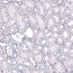 Immunohistochemical staining of human kidney shows no positivity in cells in tubules as expected.