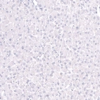 Immunohistochemical staining of human liver shows no positivity in hepatocytes as expected.
