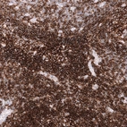 Immunohistochemical staining of human tonsil shows strong membranous positivity in lymphoid cells, mostly in the mantle zone.