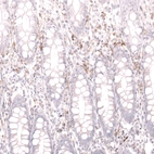 Immunohistochemical staining of human rectum shows moderate membranous positivity in lymphoid cells.