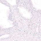 Immunohistochemical staining of human prostate shows no positivity in glandular cells as expected.