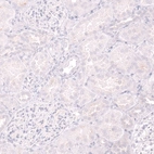 Immunohistochemical staining of human kidney shows no positivity in cells in tubules as expected.