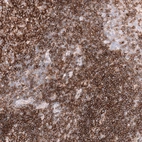 Immunohistochemical staining of human tonsil shows strong membranous positivity in lymphoid cells, mainly in the mantle zone.