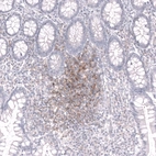 Immunohistochemical staining of human small intestine shows strong membranous positivity in lymphoid cells.
