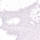 Immunohistochemical staining of human prostate shows no positivity in glandular cells as expected.