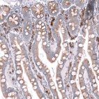 Immunohistochemical staining of human duodenum shows strong membranous-cytoplasmic positivity in lymphoid cells and moderate cytoplasmic positivity in glandular cells.
