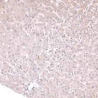 Immunohistochemical staining of human liver shows very weak cytoplasmic positivity in hepatocytes.