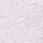 Immunohistochemical staining of human skeletal muscle shows no positivity in myocytes as expected.