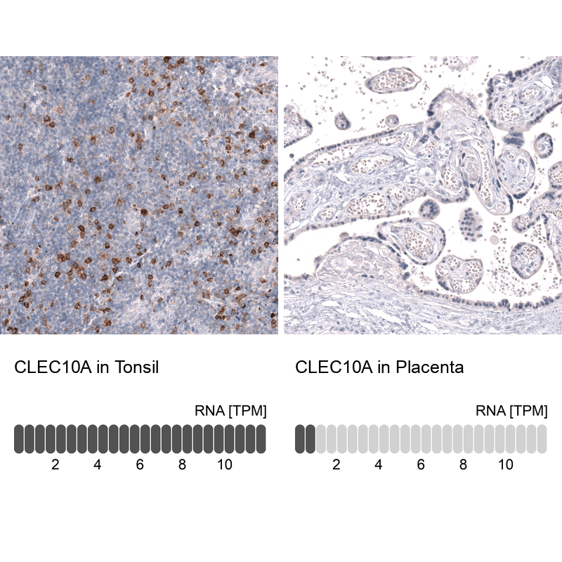 Anti-CLEC10A Antibody