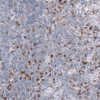 Immunohistochemical staining of human tonsil shows strong membranous-cytoplasmic positivity in non-germinal center cells.