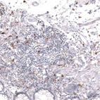 Immunohistochemical staining of human rectum shows strong membranous-cytoplasmic positivity in lymphoid cells.