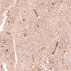 Immunohistochemical staining of human cerebral cortex shows moderate membranous-cytoplasmic positivity in endothelial cells and neuropil.
