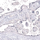 Immunohistochemical staining of human placenta shows no positivity in trophoblastic cells as expected.