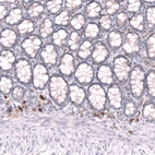 Immunohistochemical staining of human colon shows strong membranous positivity in lymphoid cells.