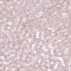 Immunohistochemical staining of human liver shows moderate cytoplasmic and membranous positivity in hepatocytes.