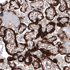 Immunohistochemical staining of human placenta shows strong cytoplasmic positivity in trophoblastic cells.