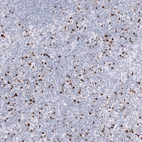 Immunohistochemical staining of human lymph node shows strong nuclear positivity in non-germinal center cells.